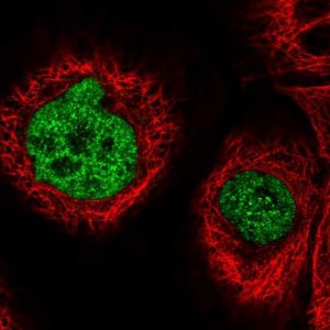 Anti-ST7 antibody produced in rabbit 