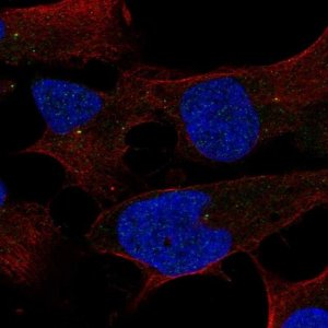Anti-ST7L antibody produced in rabbit 