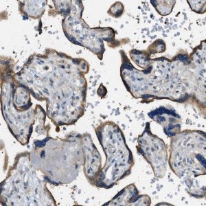 Anti-STARD13 antibody produced in rabbit 