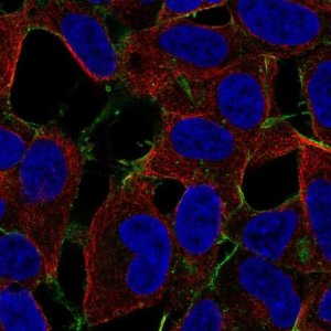 Anti-STARD4 antibody produced in rabbit 