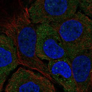 Anti-STARD5 antibody produced in rabbit 
