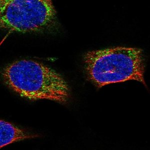 Anti-STARD7 antibody produced in rabbit 