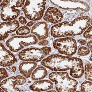 Anti-STARD8 antibody produced in rabbit 