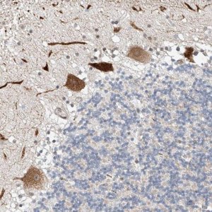 Anti-STARD9 antibody produced in rabbit 