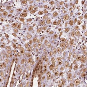 Anti-STAT3 antibody produced in rabbit HPA001671-100UL