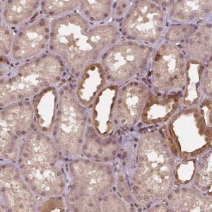Anti-STAT3 antibody produced in rabbit HPA001671-100UL