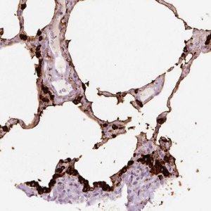 Anti-STEAP1 antibody produced in rabbit 
