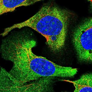 Anti-STEAP3 antibody produced in rabbit HPA050510-100UL