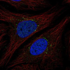 Anti-STEAP4 antibody produced in rabbit 