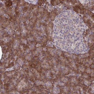 Anti-STIM2 antibody produced in rabbit 