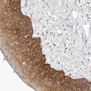 Anti-STK16 antibody produced in rabbit 