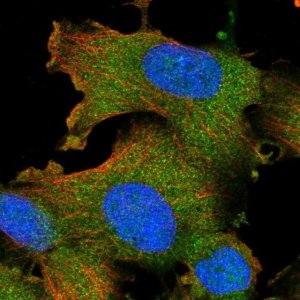 Anti-STK16 antibody produced in rabbit 