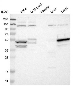 Anti-STK17A antibody produced in rabbit 