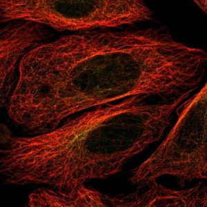 Anti-STK32B antibody produced in rabbit 