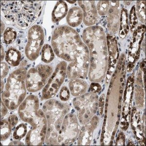 Anti-STK32B antibody produced in rabbit HPA015820-100UL