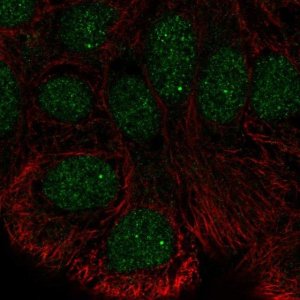 Anti-STK35 antibody produced in rabbit 