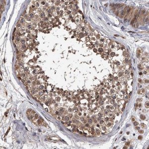 Anti-STK36 antibody produced in rabbit 