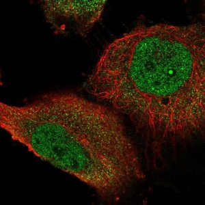 Anti-STOX1 antibody produced in rabbit 