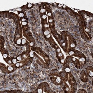 Anti-STRADA antibody produced in rabbit 
