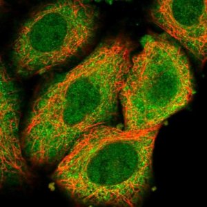 Anti-STRADA antibody produced in rabbit 