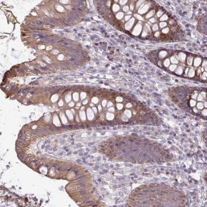 Anti-STRIP1 antibody produced in rabbit HPA060302-100UL