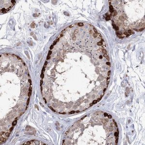 Anti-STT3B antibody produced in rabbit 