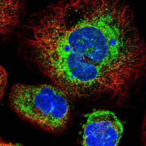 Anti-STT3B antibody produced in rabbit 