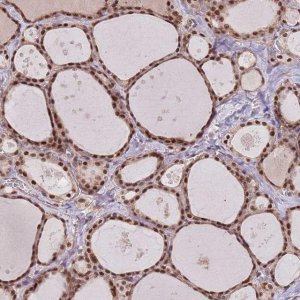 Anti-SUDS3 antibody produced in rabbit 