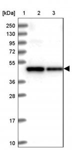 Anti-SUDS3 antibody produced in rabbit 