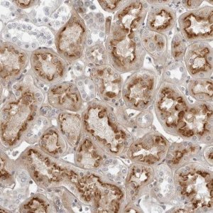 Anti-SUGCT antibody produced in rabbit 