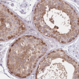 Anti-SUGT1 antibody produced in rabbit HPA043949-100UL