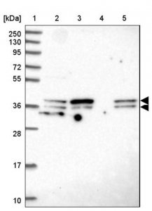 Anti-SUGT1 antibody produced in rabbit HPA043949-100UL