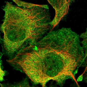 Anti-SUPT6H antibody produced in rabbit 