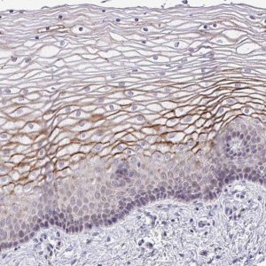 Anti-SUSD4 antibody produced in rabbit 