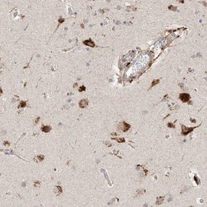 Anti-SUSD6 antibody produced in rabbit 