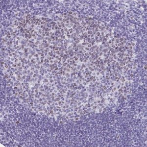 Anti-SUZ12 antibody produced in rabbit 