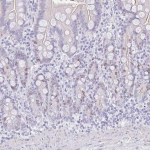 Anti-SUZ12 antibody produced in rabbit 
