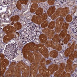Anti-SV2C antibody produced in rabbit HPA040722-100UL