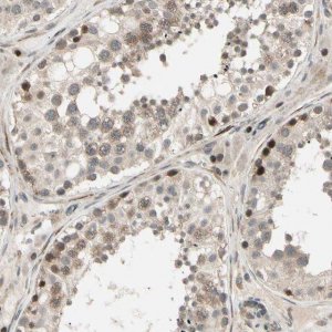 Anti-SVBP antibody produced in rabbit 