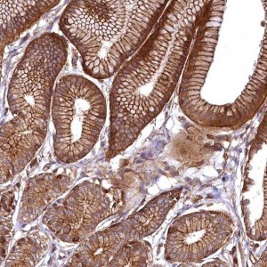 Anti-SVIP antibody produced in rabbit 