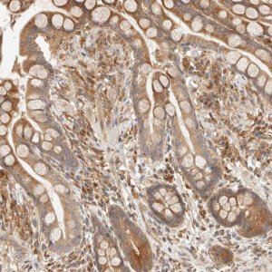 Anti-TACC1 antibody produced in rabbit 