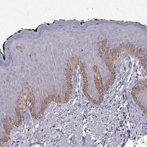 Anti-TACR1 antibody produced in rabbit 