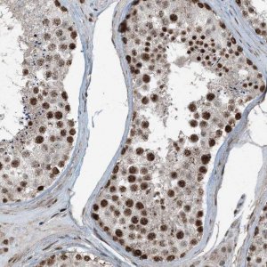 Anti-TADA2B antibody produced in rabbit 