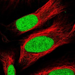 Anti-TAF13 antibody produced in rabbit 