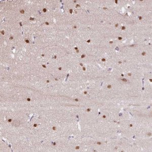Anti-TAF1A antibody produced in rabbit 