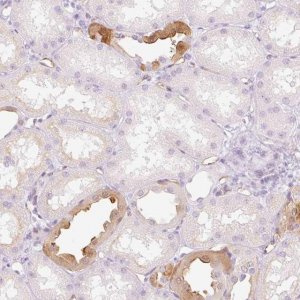 Anti-TAF1L antibody produced in rabbit 