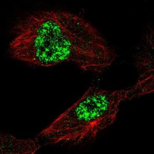 Anti-TAF5L antibody produced in rabbit 