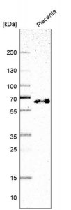 Anti-TAF5L antibody produced in rabbit 