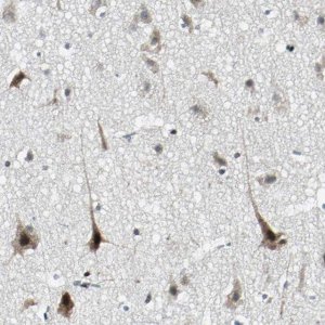 Anti-TAF6 antibody produced in rabbit HPA006566-100UL