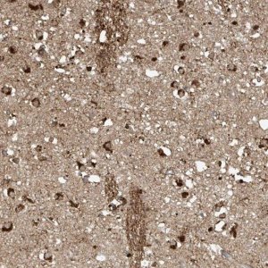 Anti-TAGAP antibody produced in rabbit 